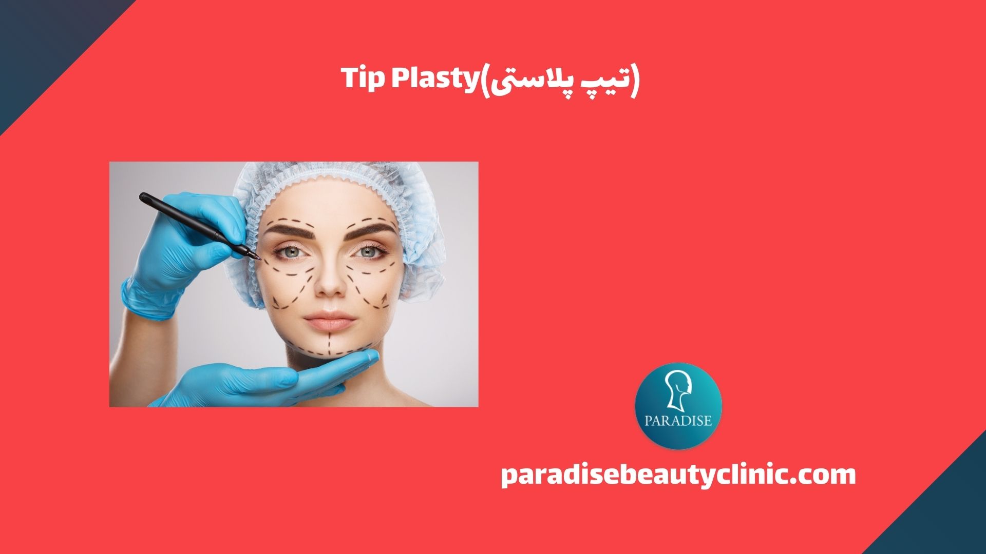 (تیپ پلاستی)Tip Plasty