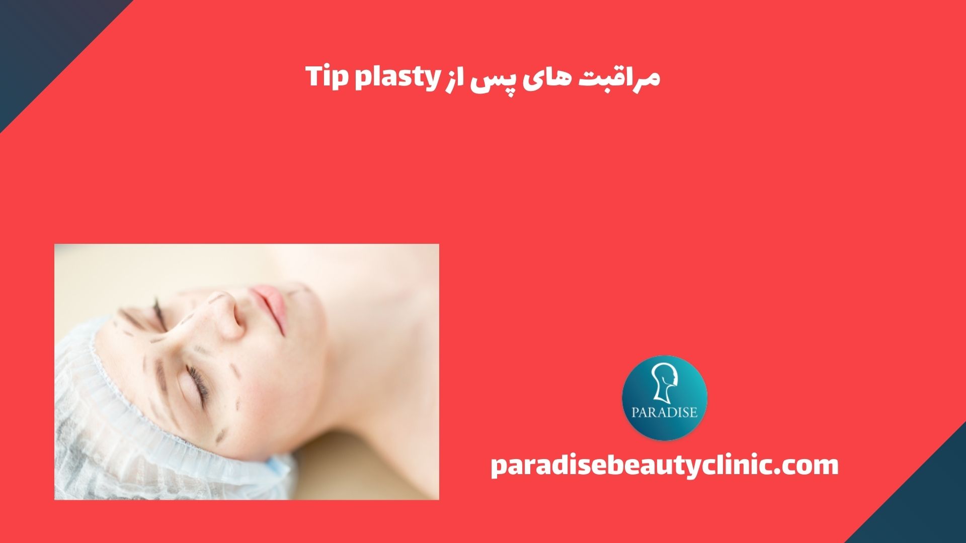 مراقبت های پس از Tip plasty