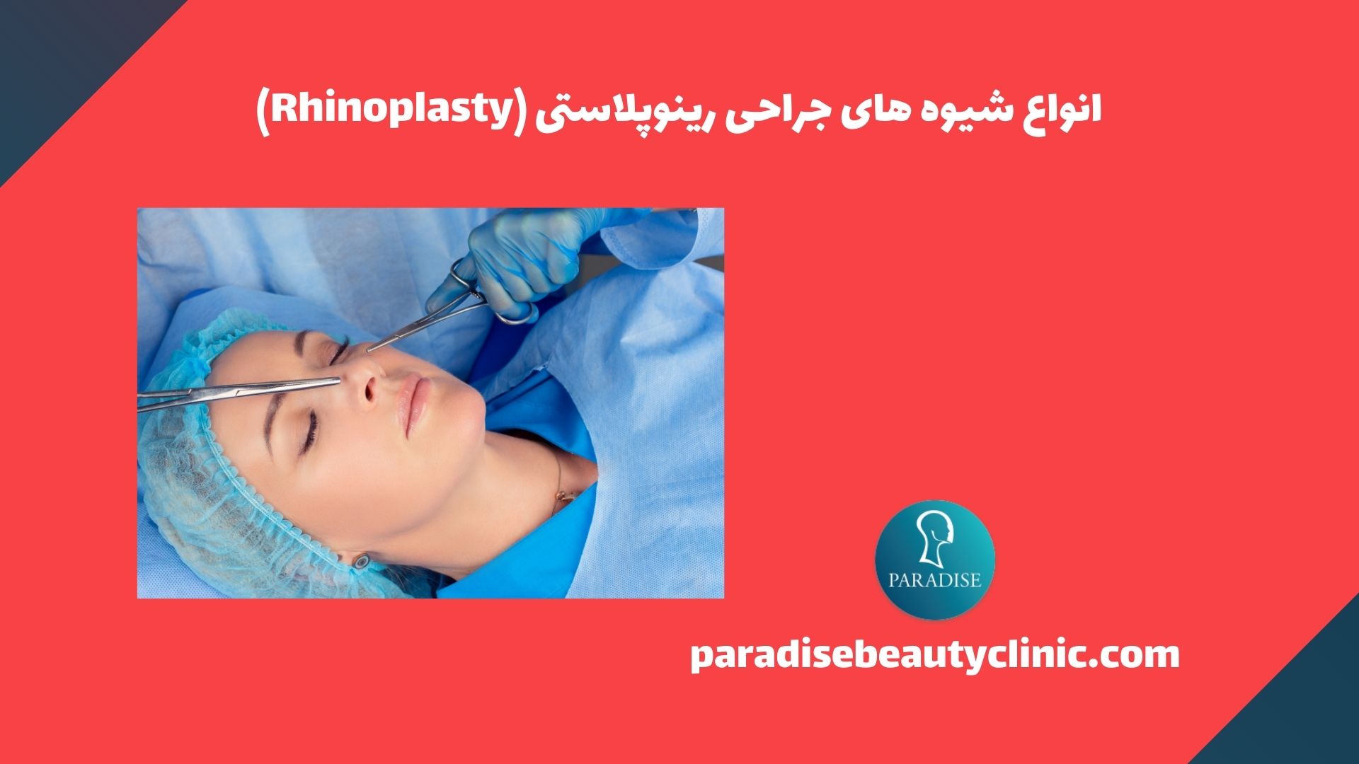 انواع شیوه های جراحی رینوپلاستی (Rhinoplasty)