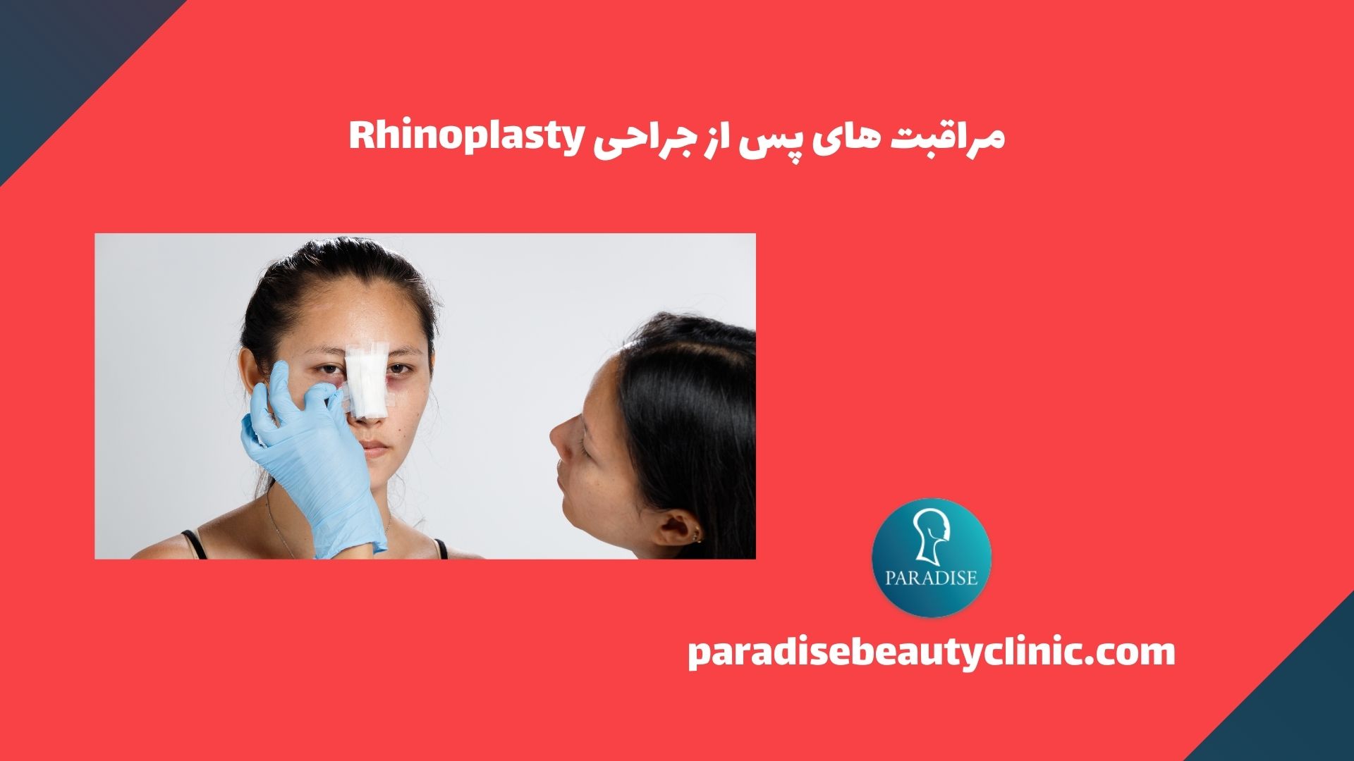 مراقبت های پس از جراحی Rhinoplasty