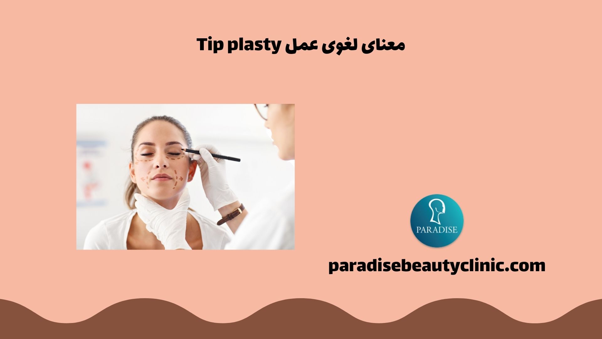 معنای لغوی عمل Tip plasty