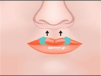 سانترال لب چیست؟ عمل زیبایی لب یا همان سانترال لب