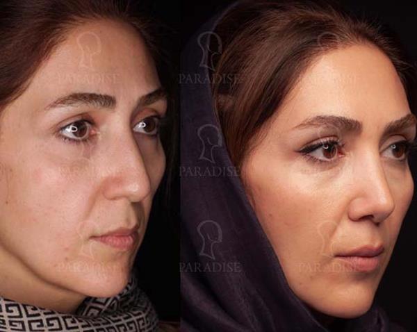 عکس تیپ پلاستی دکتر هومن گنجه خسروی