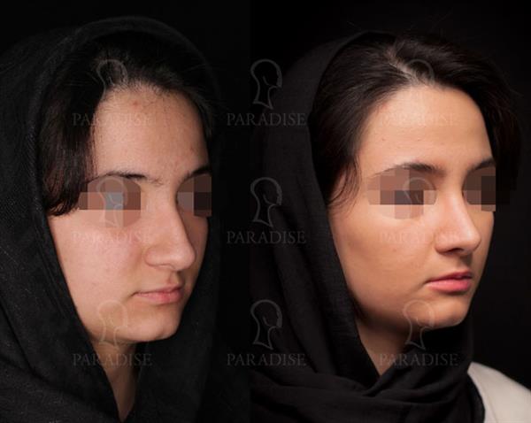 عکس از تیپ پلاستی دکتر هومن گنجه خسروی